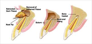 dt01112012110544Surgical